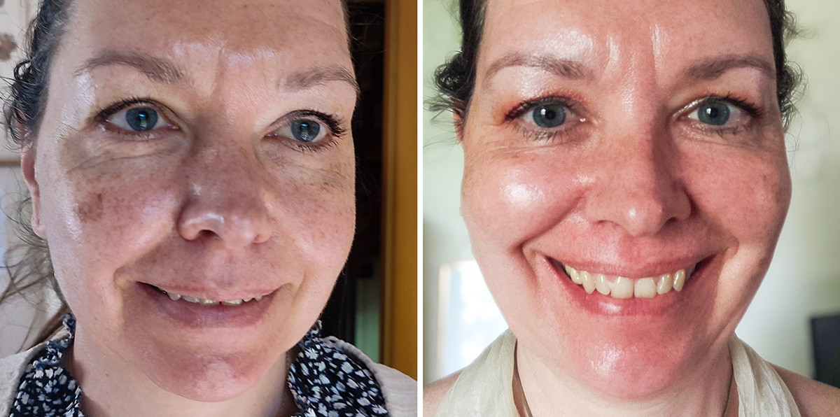 before-after