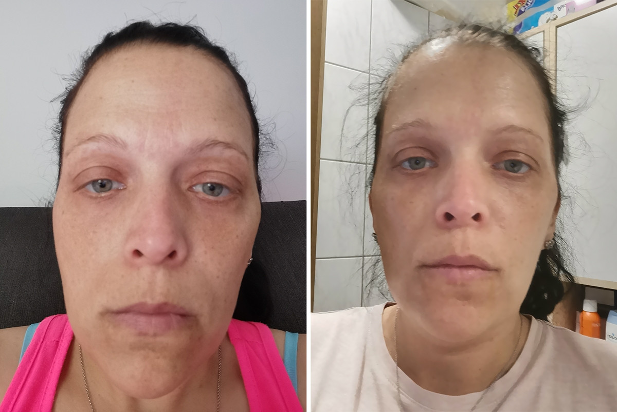 before-after