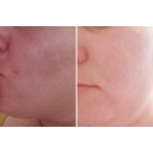 before-after-mateja-lapuh