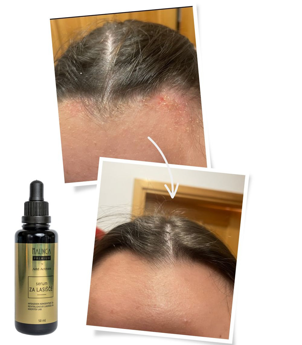 Scalp Serum 50 ml